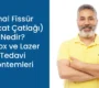 anal fissur makat catlagi nedir 90x80
