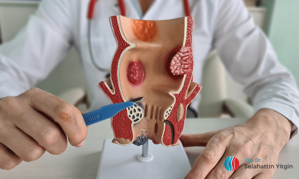 Proktoloji Doktoru Muayene Zamanı Makat Hastalıklarından Bahsediyor