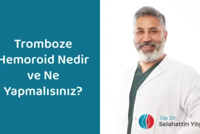 Tromboze hemoroid nedir ve ne yapmalısınız konusunu anlatan Op. Dr. Selahattin Yitgin